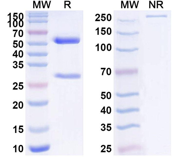 Anti-Human S1PR4 Recombinant Monoclonal Antibody (SAA1540) - SDS-PAGE