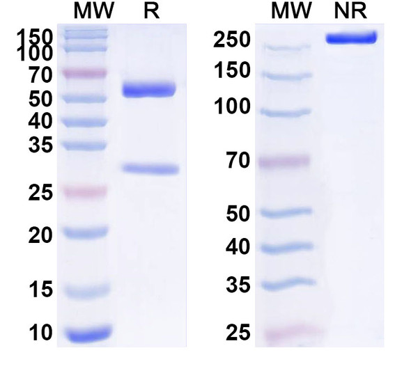 Anti-Human IL1RN/IL-1ra/IL1F3 Recombinant Monoclonal Antibody (SAA1542) - SDS-PAGE