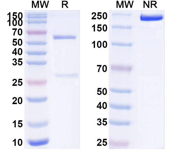 Anti-Human S100B Recombinant Monoclonal Antibody (SAA1555) - SDS-PAGE