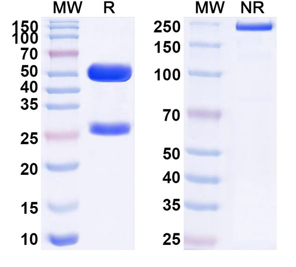 Anti-Human LCK Recombinant Monoclonal Antibody (SAA1559) - SDS-PAGE