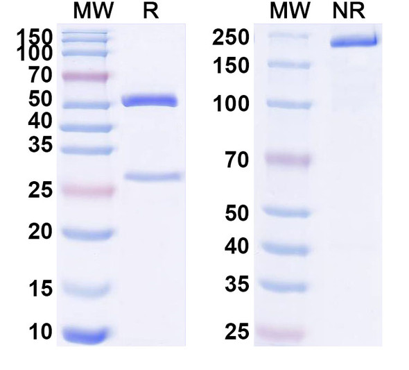 Anti-Human CD97/ADGRE5 Recombinant Monoclonal Antibody (SAA1566) - SDS-PAGE