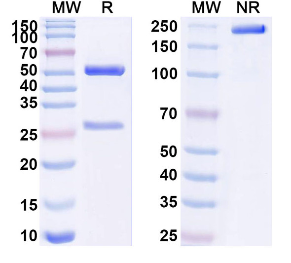 Anti-Human BCR Recombinant Monoclonal Antibody (SAA1570) - SDS-PAGE