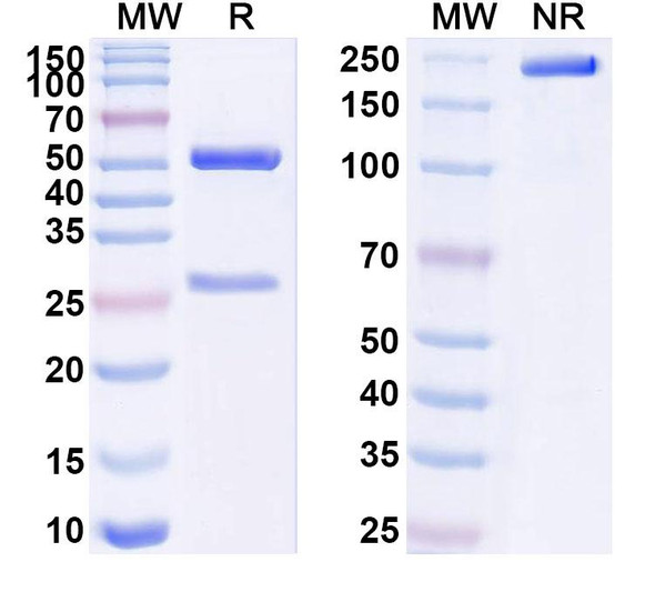 Anti-Human BCR Recombinant Monoclonal Antibody (SAA1570) - SDS-PAGE