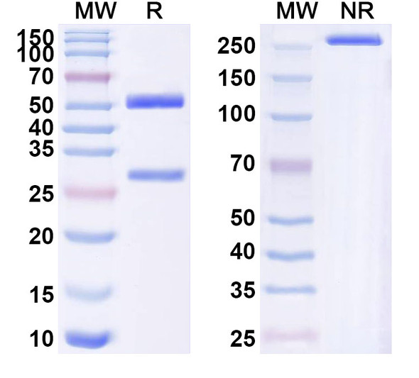 Anti-Human MMP16 Recombinant Monoclonal Antibody (SAA1573) - SDS-PAGE