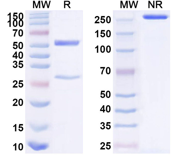 Anti-Human ITGA9 Recombinant Monoclonal Antibody (SAA1586) - SDS-PAGE