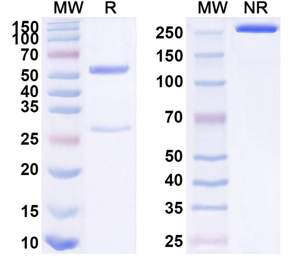Anti-Human IGFBP3 Recombinant Monoclonal Antibody (SAA1589) - SDS-PAGE