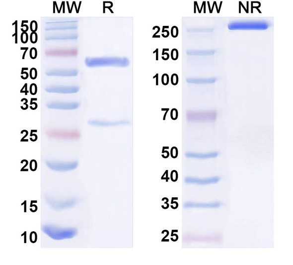 Anti-Human WT1 Recombinant Monoclonal Antibody (SAA1594) - SDS-PAGE