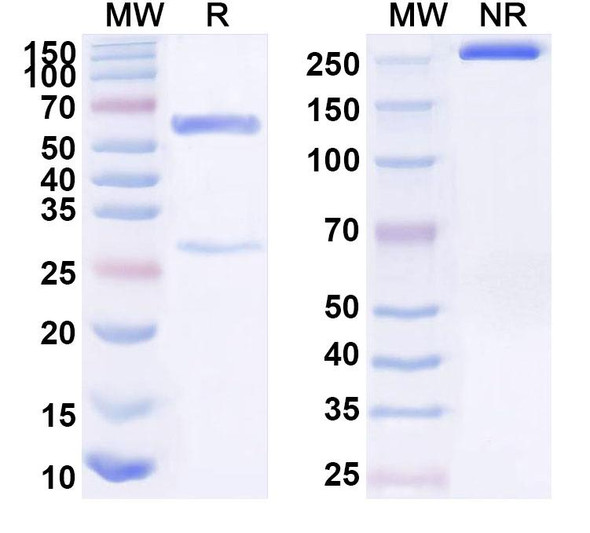 Anti-Human WT1 Recombinant Monoclonal Antibody (SAA1594) - SDS-PAGE
