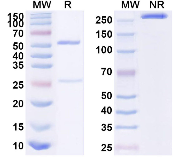 Anti-Human EN2 Recombinant Monoclonal Antibody (SAA1595) - SDS-PAGE