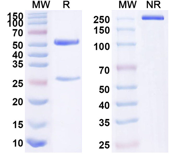 Anti-Human SFRP5 Recombinant Monoclonal Antibody (SAA1598) - SDS-PAGE