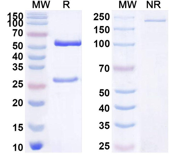 Anti-Human ASTL/Ovastacin Recombinant Monoclonal Antibody (SAA1599) - SDS-PAGE
