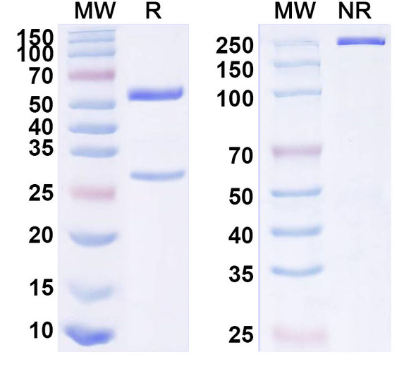 Anti-Human FGF7 Recombinant Monoclonal Antibody (SAA1603) - SDS-PAGE