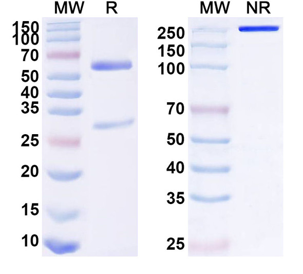 Anti-Human LHCGR Recombinant Monoclonal Antibody (SAA1607) - SDS-PAGE