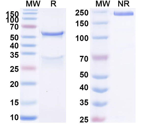 Anti-Human EPHB2 Recombinant Monoclonal Antibody (SAA1617) - SDS-PAGE