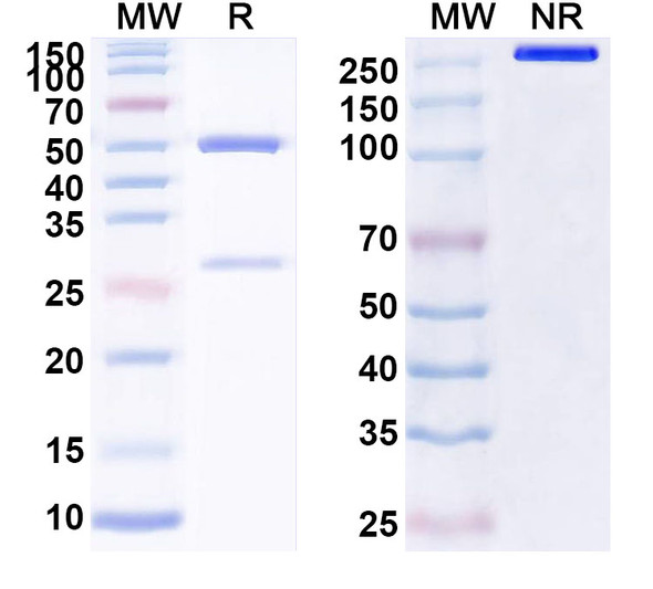 Anti-Human PRDX6 Recombinant Monoclonal Antibody (SAA1620) - SDS-PAGE