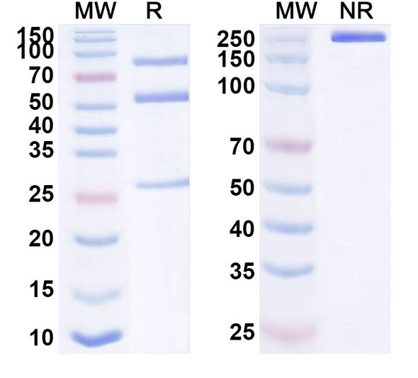 Anti-Human XCR1 Recombinant Monoclonal Antibody (SAA1638) - SDS-PAGE