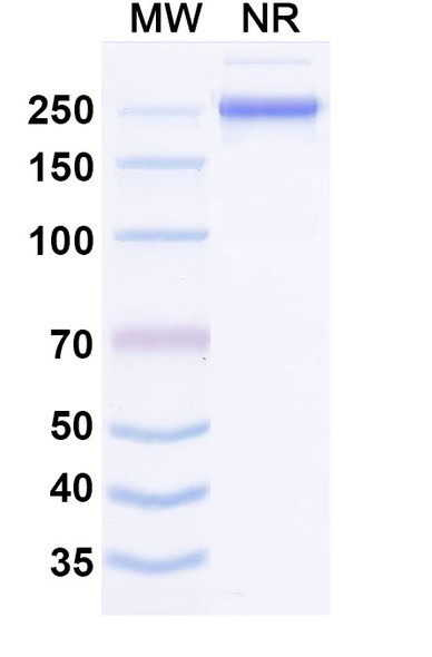 Anti-Human MASP1 Recombinant Monoclonal Antibody (SAA1639) - SDS-PAGE