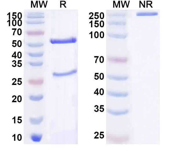 Anti-Human ASCL1 Recombinant Monoclonal Antibody (SAA1643) - SDS-PAGE
