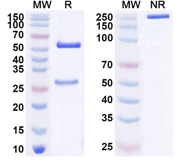 Anti-Human EPHB4 Recombinant Monoclonal Antibody (SAA1647) - SDS-PAGE