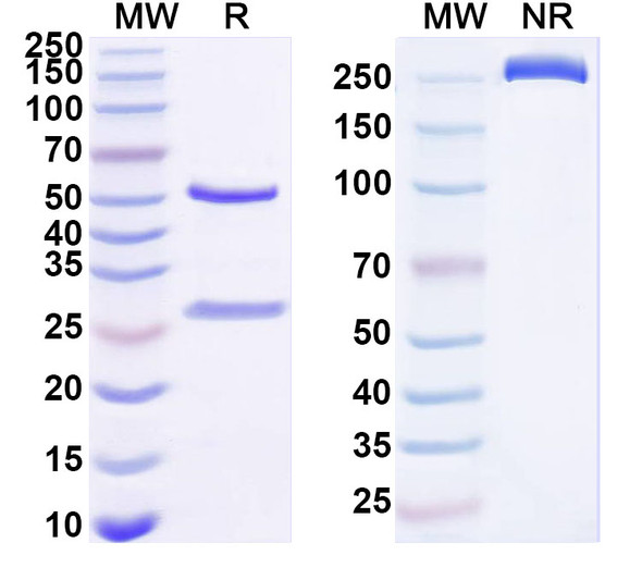 Anti-Human MEF2C Recombinant Monoclonal Antibody (SAA1659) - SDS-PAGE