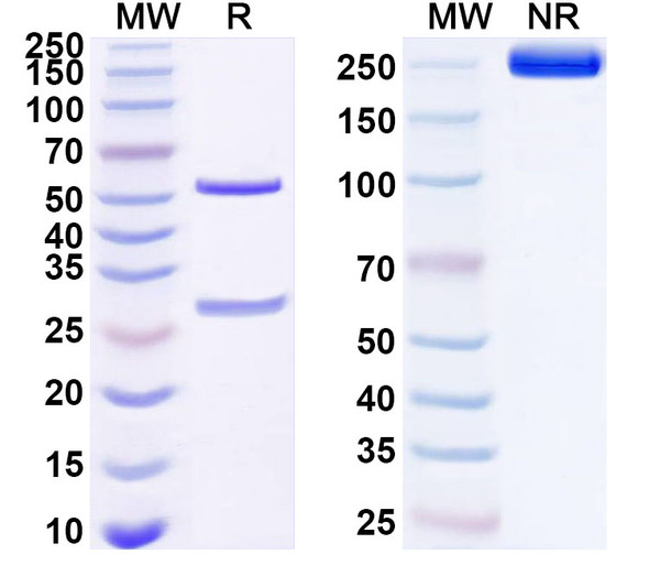 Anti-Human BAMBI Recombinant Monoclonal Antibody (SAA1666) - SDS-PAGE