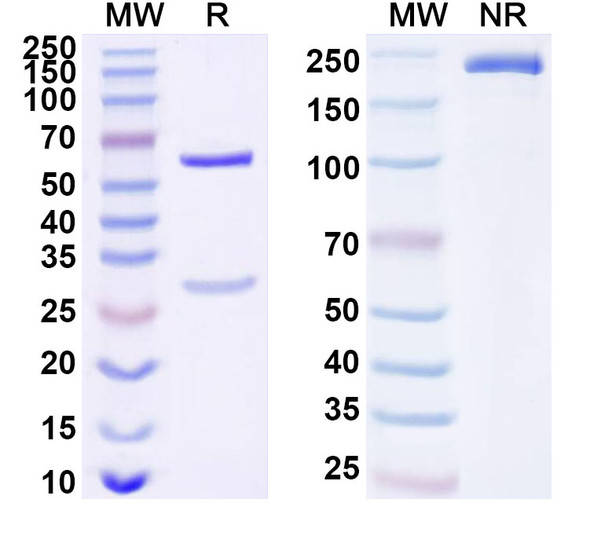 Anti-Human MCM6 Recombinant Monoclonal Antibody (SAA1677) - SDS-PAGE