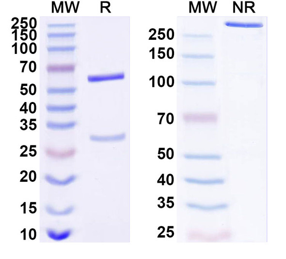 Anti-Human CDK5R1 Recombinant Monoclonal Antibody (SAA1679) - SDS-PAGE