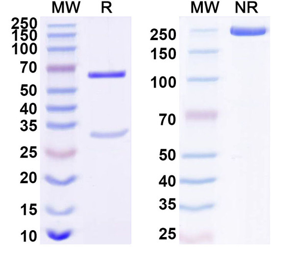 Anti-Human NFKBIB Recombinant Monoclonal Antibody (SAA1682) - SDS-PAGE