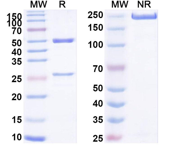 Anti-Human TMEM132A Recombinant Monoclonal Antibody (SAA1686) - SDS-PAGE
