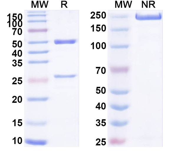 Anti-Human MICB Recombinant Monoclonal Antibody (SAA1687) - SDS-PAGE