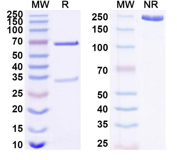 Anti-Human MICA Recombinant Monoclonal Antibody (SAA1688) - SDS-PAGE