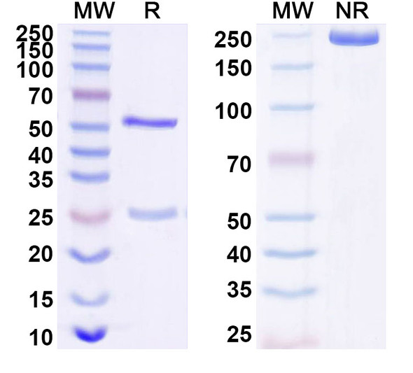 Anti-Human TM4SF20 Recombinant Monoclonal Antibody (SAA1694) - SDS-PAGE