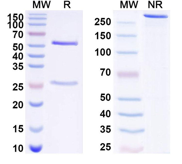 Anti-Human LSR Recombinant Monoclonal Antibody (SAA1701) - SDS-PAGE