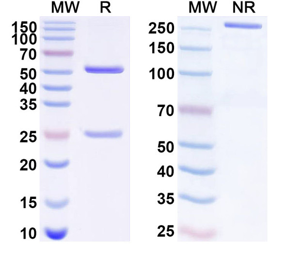 Anti-Human ACVR1C Recombinant Monoclonal Antibody (SAA1706) - SDS-PAGE