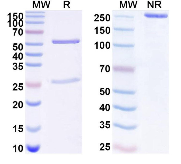 Anti-Human LOXL4 Recombinant Monoclonal Antibody (SAA1710) - SDS-PAGE