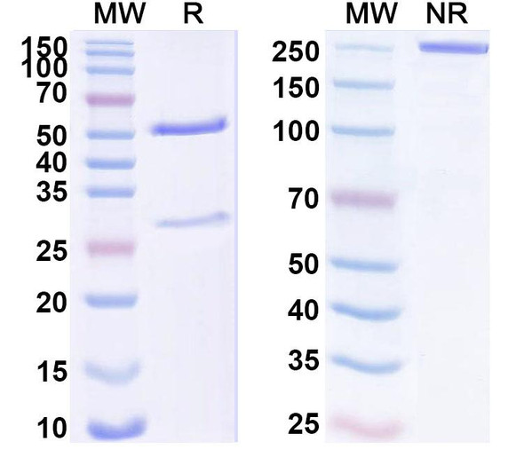 Anti-Human NODAL Recombinant Monoclonal Antibody (SAA1711) - SDS-PAGE