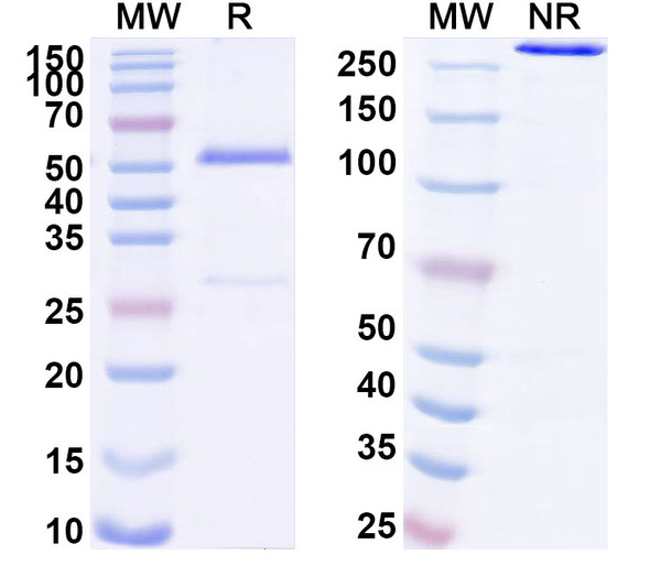 Anti-Human LGR6 Recombinant Monoclonal Antibody (SAA1715) - SDS-PAGE