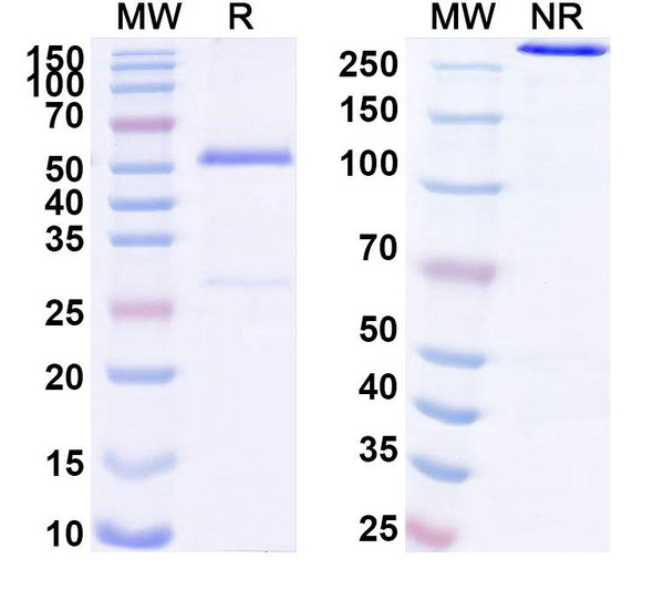 Anti-Human KCNK9 Recombinant Monoclonal Antibody (SAA1716) - SDS-PAGE