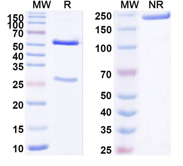 Anti-Human APOBEC3B Recombinant Monoclonal Antibody (SAA1722) - SDS-PAGE