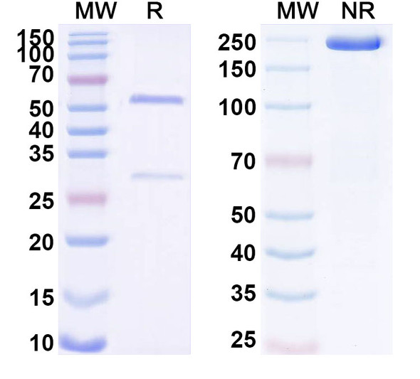 Anti-Human PADI4 Recombinant Monoclonal Antibody (SAA1724) - SDS-PAGE