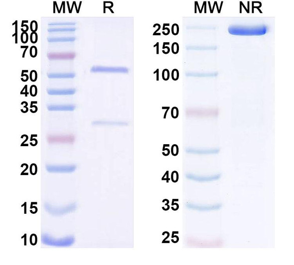 Anti-Human ING4 Recombinant Monoclonal Antibody (SAA1725) - SDS-PAGE
