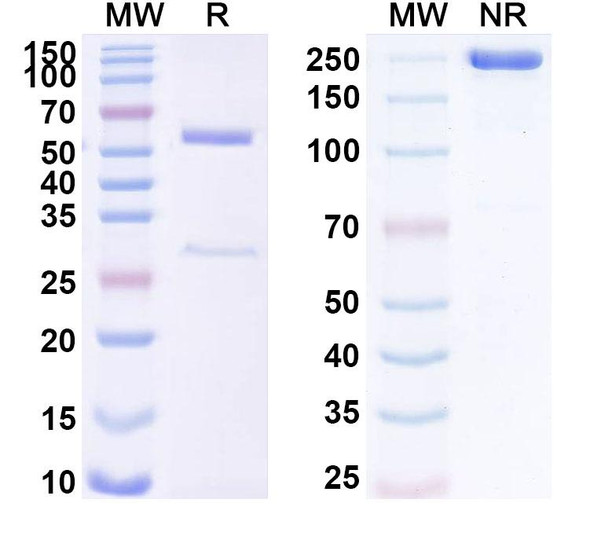 Anti-Human DICER1 Recombinant Monoclonal Antibody (SAA1726) - SDS-PAGE