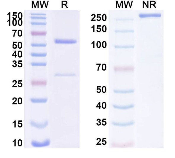 Anti-Human MOSPD2 Recombinant Monoclonal Antibody (SAA1731) - SDS-PAGE