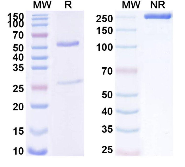 Anti-Human CD172b/SIRPB1 Recombinant Monoclonal Antibody (SAA1734) - SDS-PAGE