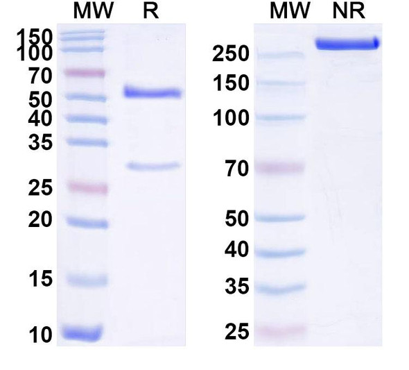 Anti-Human ROS1 Recombinant Monoclonal Antibody (SAA1737) - SDS-PAGE