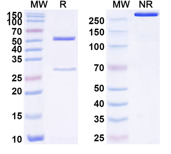 Anti-Human TNK1 Recombinant Monoclonal Antibody (SAA1740) - SDS-PAGE