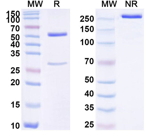 Anti-Human STIM1 Recombinant Monoclonal Antibody (SAA1741) - SDS-PAGE