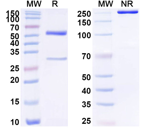 Anti-Human SLC39A12 Recombinant Monoclonal Antibody (SAA1744) - SDS-PAGE