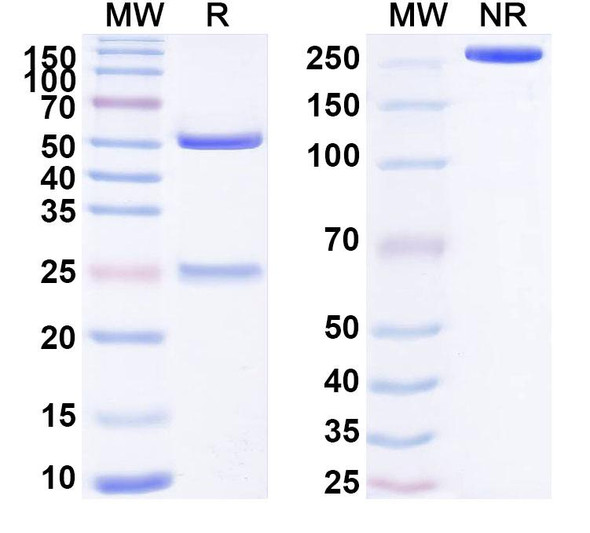 Anti-Human BRAF/B-Raf Recombinant Monoclonal Antibody (SAA1756) - SDS-PAGE