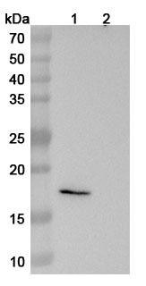 Anti-Human RNF43 Recombinant Monoclonal Antibody (SAA1758) - WB